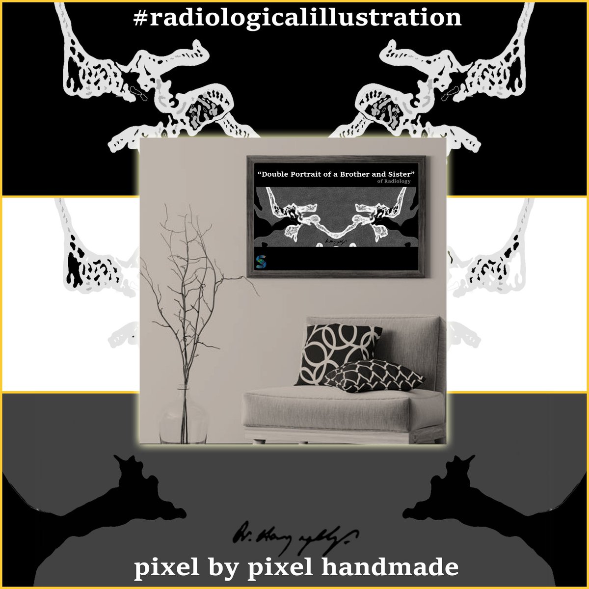 Temporal Bone -2 

Normal temporal bone CT with "non-annotated radiologicalillustrations"
Stay tuned for annotated illustrations and pathologies! 😇 

#TBoneTime
#radiologicalillustration ✍️