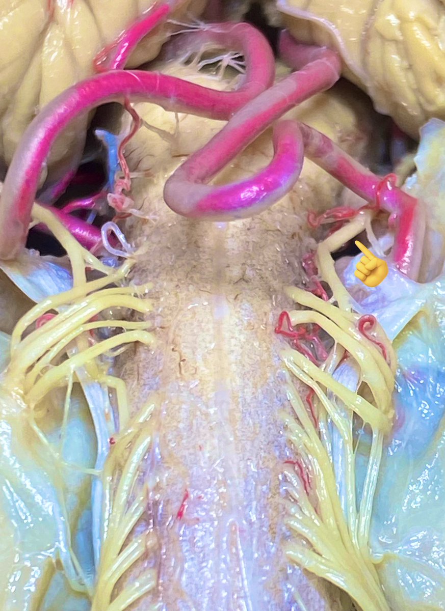 PICA👉🏻 NC XIpe