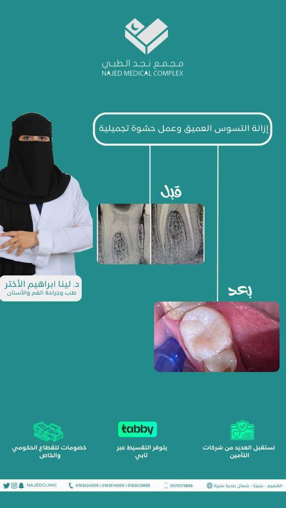 تسلم يدك دكتورة لينا الأختر الشغل ولا غلطة 🤩🤍

#مجمع_نجد #القصيم #عنيزة #نجد_الطبي
#مجمع_نجد_الطبي_في_عنيزة