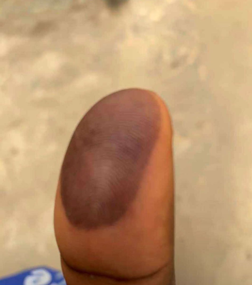 slim_lexis's tweet image. This is to 2020 #EndSARS #EndSARSProtest