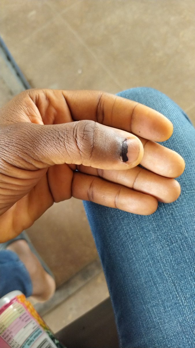 Done and Dusted!!😀😀😀

#NigeriaElections2023 
#VotePeterObiForPresident2023 
#VoteLabourParty 
#VotePeterObi4President 
#VoteLP2023