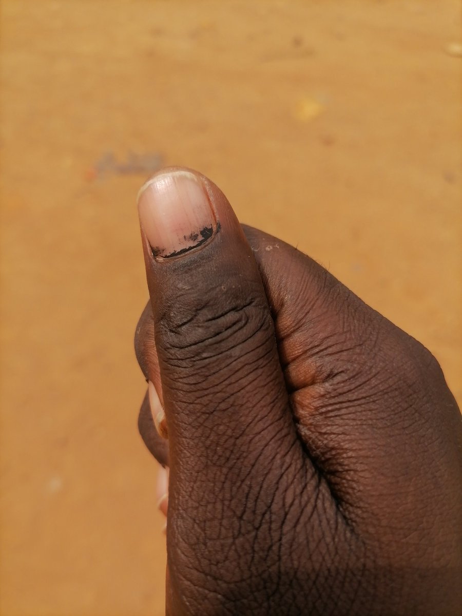 We don put am there , God well seal it