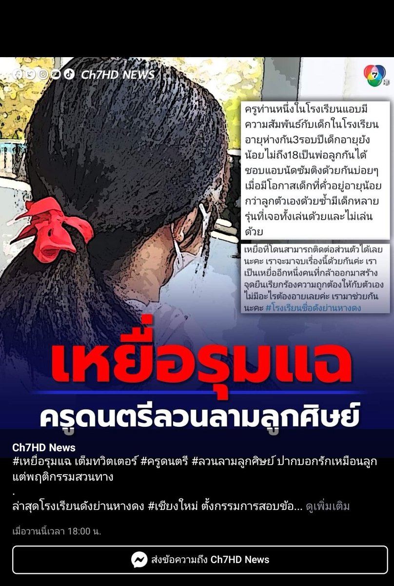 X_T-M tweet media