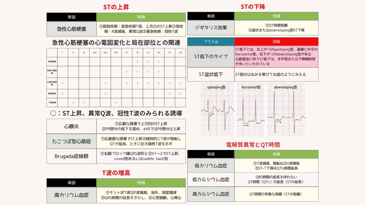 ecgkuma's tweet photo. 心電図の極意についてまとめました。 https://t.co/MvdR1qvWKA