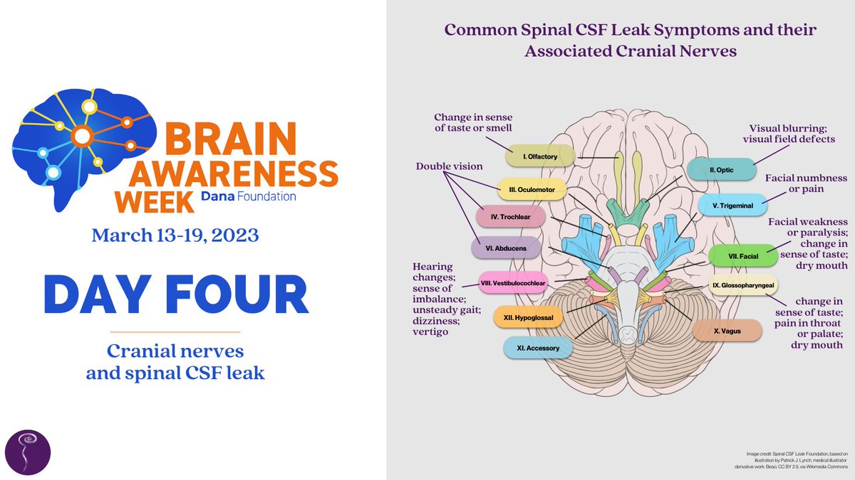 spinalCSFleak's tweet image. For Brain Awareness day four, we’re discussing the impact of spinal CSF leak on cranial nerves 
spinalcsfleak.org/brain-awarenes… #brainawarenessweek #becauseyourduramaters #spinalcsfleak