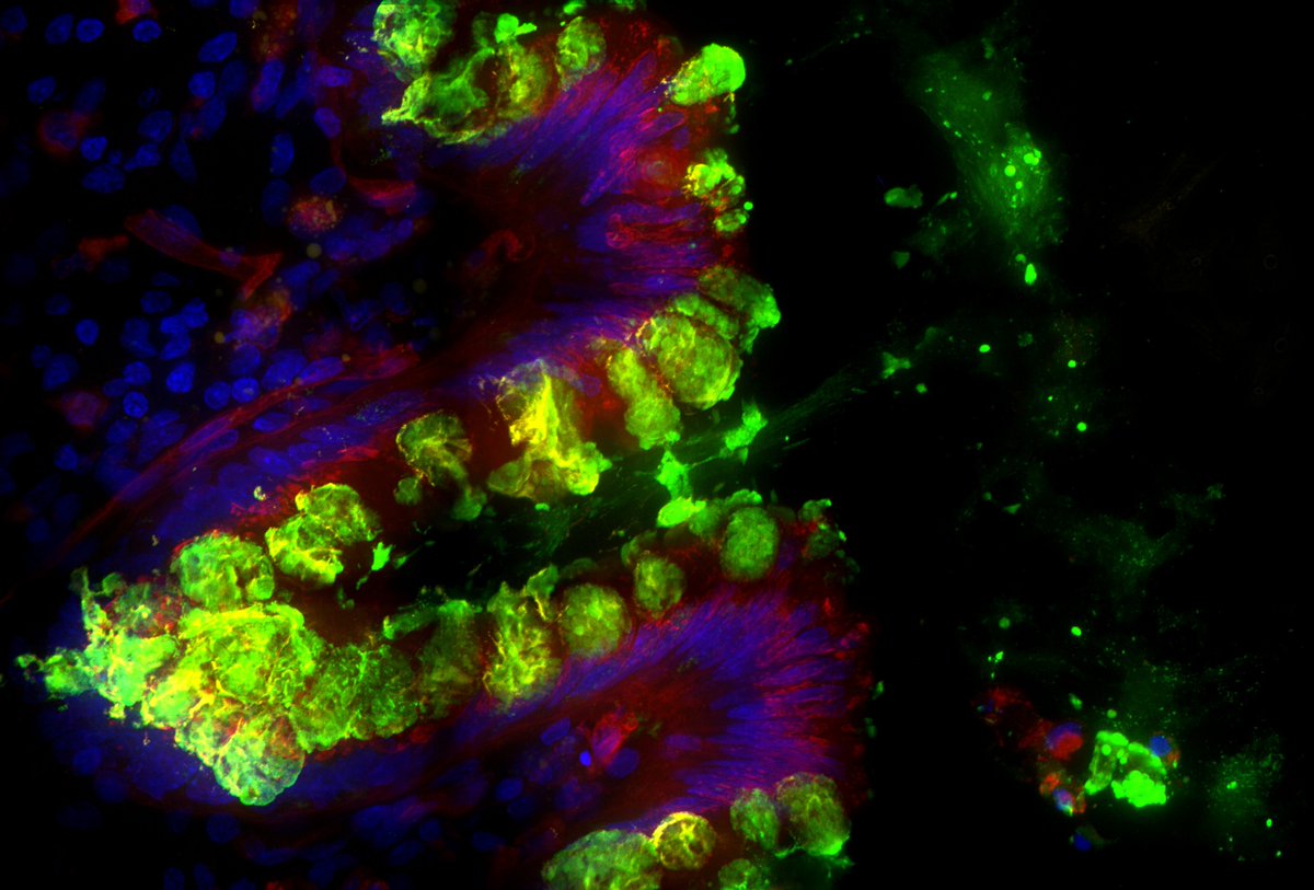 Integrated Neurogenic Mechanisms Laboratory (@inmlab) on Twitter photo For today's #FluorescenceFriday from <a href="/INMLAB/">Integrated Neurogenic Mechanisms Laboratory</a> 🔬. Goblet cells (green) protect the gut barrier by releasing plumes of mucus into the lumen. What a moment to capture! 🌟Work from <a href="/MatthewRowe_/">Matthew Rowe</a> & <a href="/Dan_Poolio/">Dan Poole</a>. For today's #FluorescenceFriday from <a href="/INMLAB/">Integrated Neurogenic Mechanisms Laboratory</a> 🔬. Goblet cells (green) protect the gut barrier by releasing plumes of mucus into the lumen. What a moment to capture! 🌟Work from <a href="/MatthewRowe_/">Matthew Rowe</a> & <a href="/Dan_Poolio/">Dan Poole</a>.