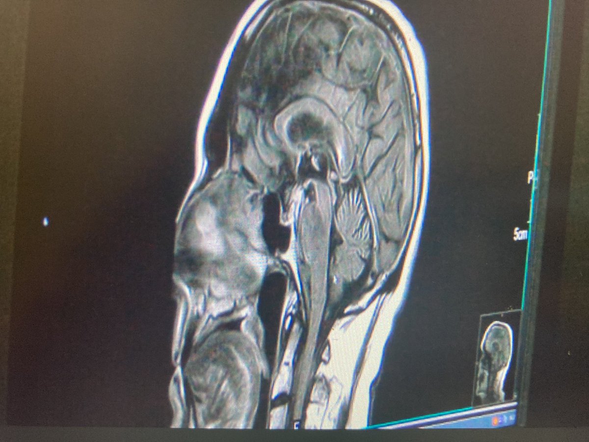 risell_v's tweet photo. @Kearneyregional now has cutting-edge MRI technology which has better imaging, can take in patients who weight up to 550lb, makes patient exams way faster, and more… today they hosted a ribbon cutting for the new technology, all the details will soon be on our website @NTVNEWS https://t.co/k9N6xGzzND