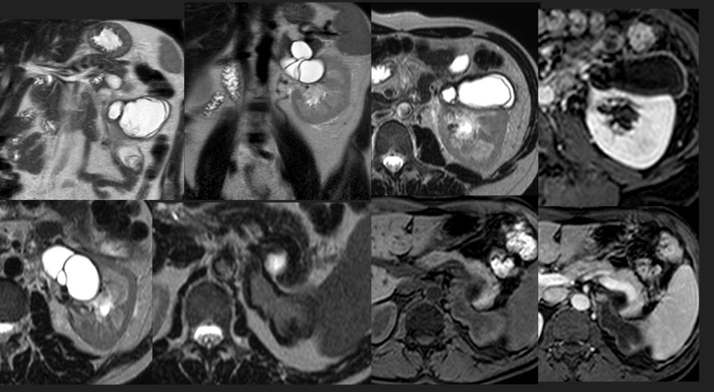 Ramon Coronil tweet media