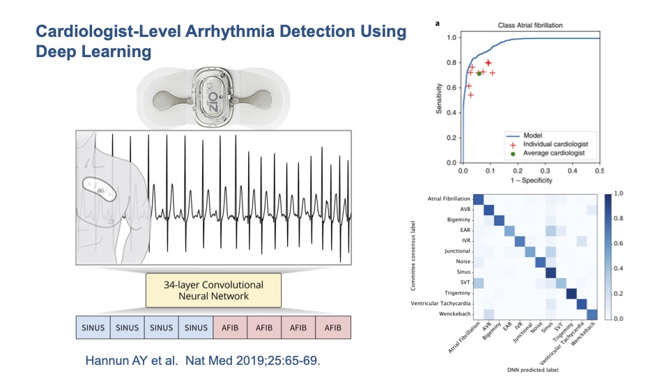 Late to twitter but @ramseywehbemd and I had a blast presenting at medicine grand rounds @MUSC_IM on the present and future of #AI #deeplearning #NLP in #cardiovascular care. Here are our favorite slides (title slide was created using #dalle2) @MUSChealth @MUSC_Cardiology