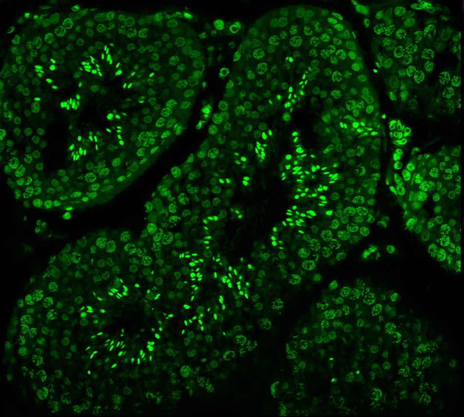 My lab neighbors study spermatogenesis, and when they found out Oswald was getting neutered, they wasted no time asking for the specimen! Who knew dog testicles could be so beautiful under a microscope? (The bright spots are individually stained nuclei.)
P/C Dominic Bazzano