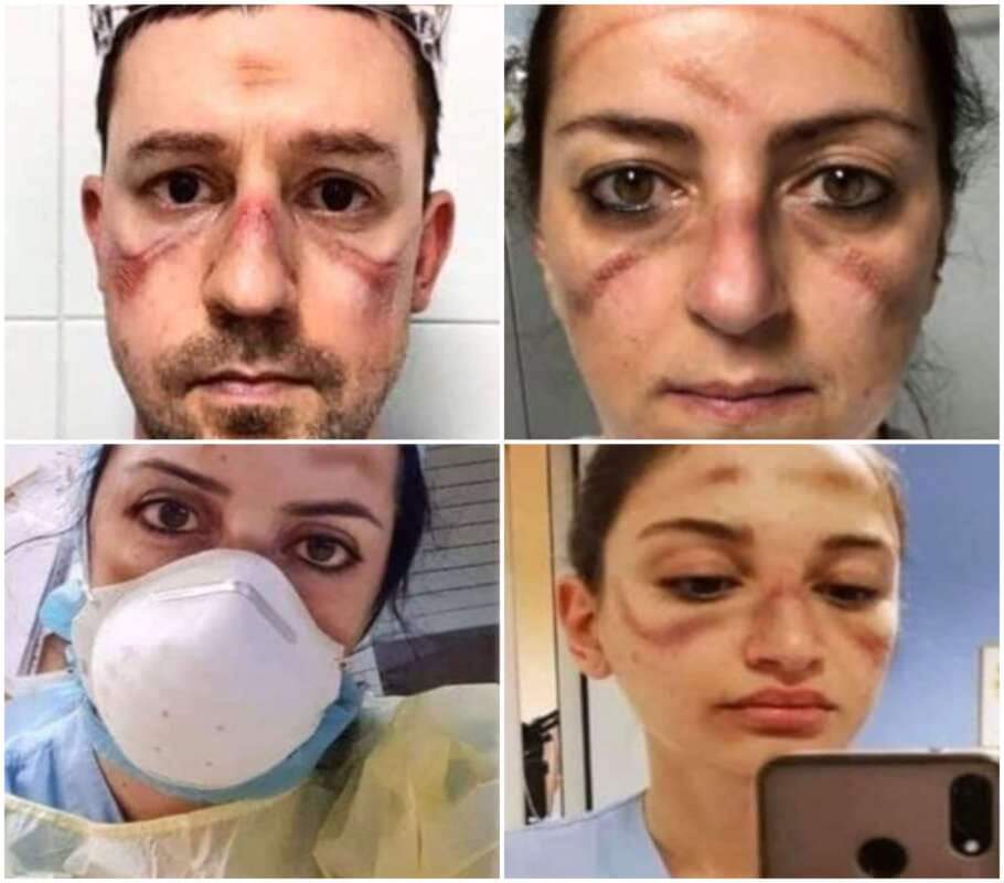 Carlo96446381's tweet photo. Tweet fatto tempo fa che ripeto.
Faccio subacquea e ho portato la maschera da sub per diverse ore che stringe ben più delle maschere da sanitario e non ho mai avuto ne ho mai visto ad altri quei segni. https://t.co/gdG44X0mUR