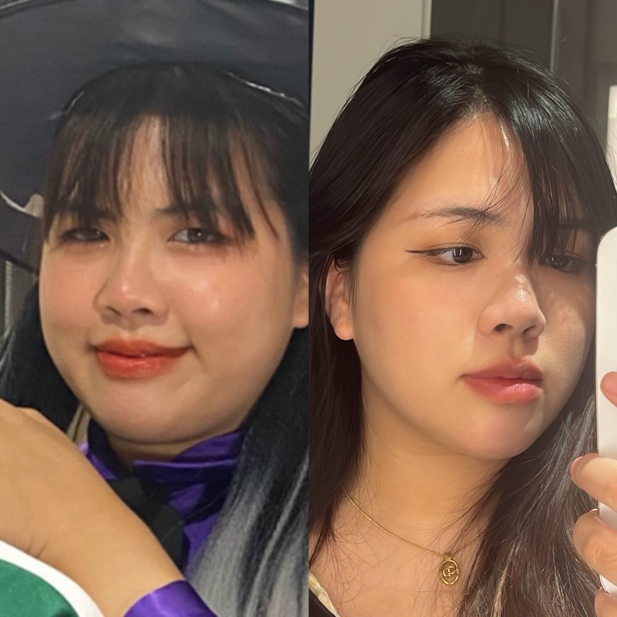 มีคนสงสัยว่า น้ำหนัก80+จริงมั้ย คือจริง 82-84ด้วย🥹 อาจจะดูไม่ถึงเพราะสูงและหมั่นเข้าคลีนิค อันนี้ล่าสุดที่ทำคือ ultra reformer ที่ to me clinic สยามนะคะ ครบเดือนแล้วตอนนี้เห็นผลชัดมากกกกกกก มากที่สุด ไม่ต้องนั่งตุ๊งรูปให้เหนื่อย รูปซ้ายคือก่อนเริ่มเข้าคลีนิค น้ำหนักเท่ากันเป๊ะ