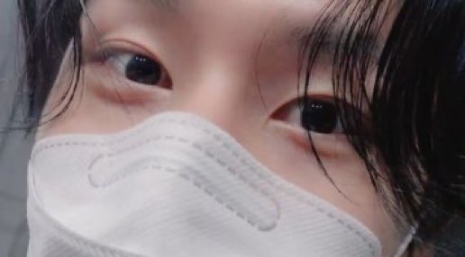 운쏘 tweet media