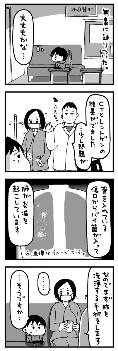 妻手術する 