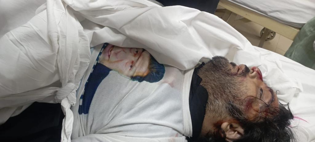 KDFeder's tweet photo. The death of an innocent Pakistani citizen  in Police custody because of violence is totally inhumane and a question mark on human rights authorities that if  voice can be raised over George Floyd death, then why not for Bilal Ali?
@hrw @amnesty https://t.co/yQHlGpg3mD