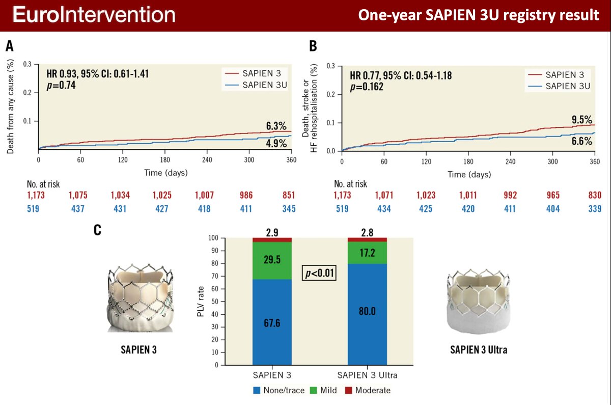 In this real-world, multicentre European study, the authors found that the SAPIEN 3 Ultra was associated with a lower rate of PVL compared to its predecessor (S3), a result that was maintained at 1 year. #EAPCI @saia_francesco @G_Tarantini01 @tambucor ow.ly/KgPr50Nf0VG