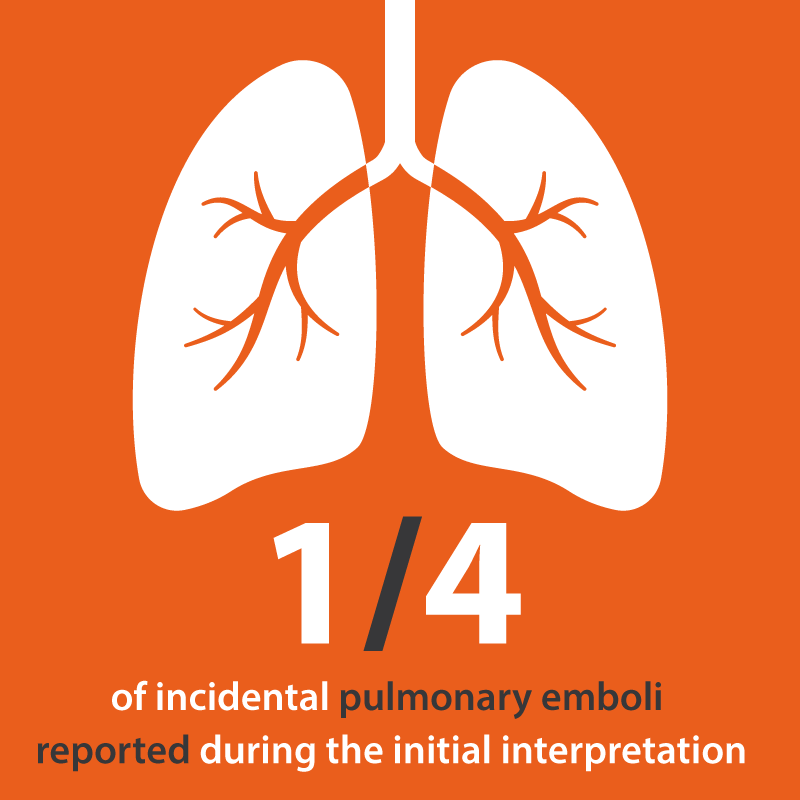 OleaMedical's tweet photo. #OleaAcademy Delayed or missed findings are some of the most serious problems in diagnostic Imaging. With the increase of cross-sectional exams, the potential of incidental findings has grown a lot for the past few decades.
#PulmonaryEmbolism #IncidentalFinding #OffsearchFindings https://t.co/nC6NWfdyNM