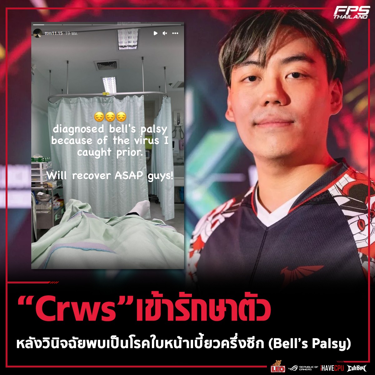 Crws สมาชิกจากทีม Talon  เข้ารับการรักษาตัวที่่โรงพยาบาลเนื่่องจากหมอวินิจฉัยพบว่าเป็นโรคใบหน้าเบี้ยวครึ่งซีก  ซึ่งเจ้าตัวได้เผยว่าสาเหตุอาจมาจากการที่เขาติดเชื้อ โดยโรคนี้จะมีอาการคล้าย  ๆ กับโรคใบหน้าอัมพาตครึ่งซีกที่เกิดขึ้นกับซุปเปอร์สตาร์ชื่อดังระดับ ..., image size:1200x1200