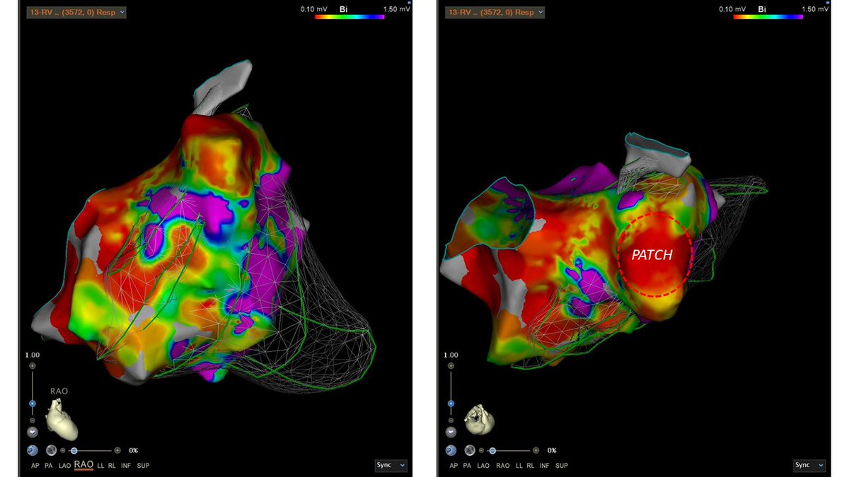 VOLTAGE MAP (RAO and RAO-CRA)