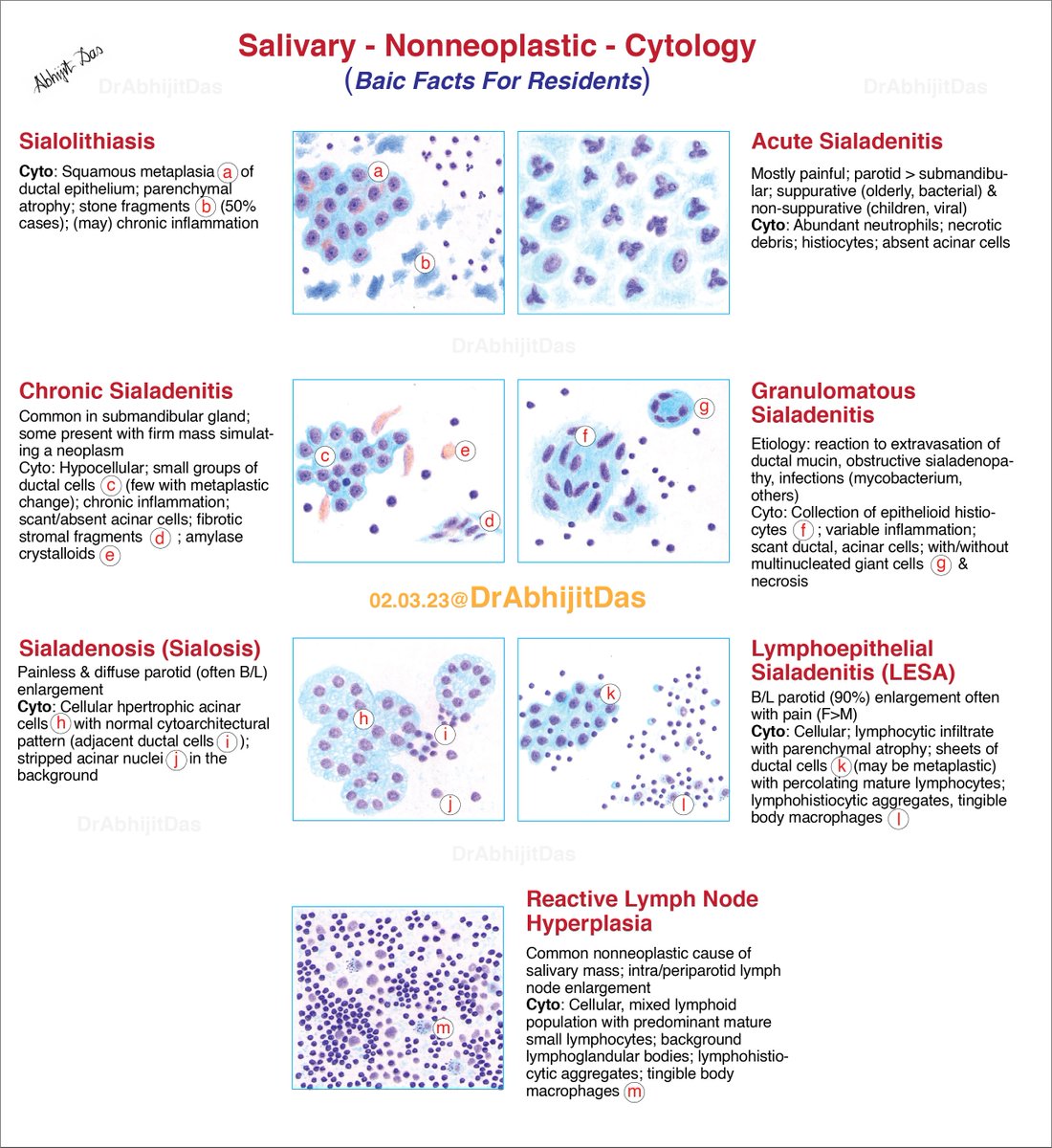 SALIVARY NONNEOPLASTIC LESIONS: Basic Cytology for Residents Sialolithiasis Sialadenitis Sialadenosis LESA #MakeCytoPathEasy #SalivaryNonneoplastic #BFFR