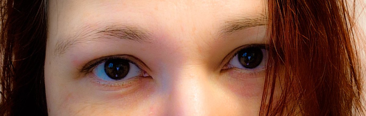 Pur 
ungeschminkt 
verletzlich