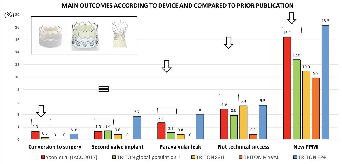 ‼️TRITON study
👉🏼Sap3Ultra-Myval-EvolutPro+ for BAV
👉🏼improvement vs. prior valve iteration
👉🏼low leak, low PPM, low embolization
🤓Read here:

authors.elsevier.com/sd/article/S18…

<a href="/ruict3/">ruicteles cardio</a> <a href="/shci_sec/">ACI-SEC: Hemodinamica</a> <a href="/PCRonline/">PCRonline 🫀</a> <a href="/TAVRBot/">TAVR Bot</a> <a href="/vallacarres/">CardioResis Valladolid</a> <a href="/Sara_Blasco/">Sara Blasco Turrión</a> <a href="/jpdebrahi/">Juan Pablo De Brahi</a> <a href="/Nelson_UBonilla/">Dr. Nelson Ulises Bonilla</a> <a href="/lamelaspablo/">Pablo Lamelas 🇦🇷🇨🇦</a>
