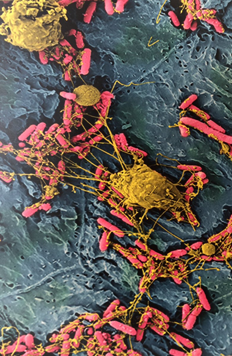 Solmentes's tweet photo. Who needs art galleries? White blood cells (yellow) reach out to immobilize and kill Escheria coli bacteria (pink) in a mouse. @broadinstitute of MIT and Harvard, Cambridge, MA https://t.co/XmldqlPG5k
