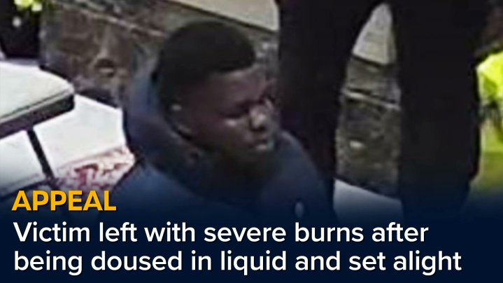 GMeltch's tweet photo. @NoirInLux Set an 82 year old man on fire. https://t.co/TREp915IQw