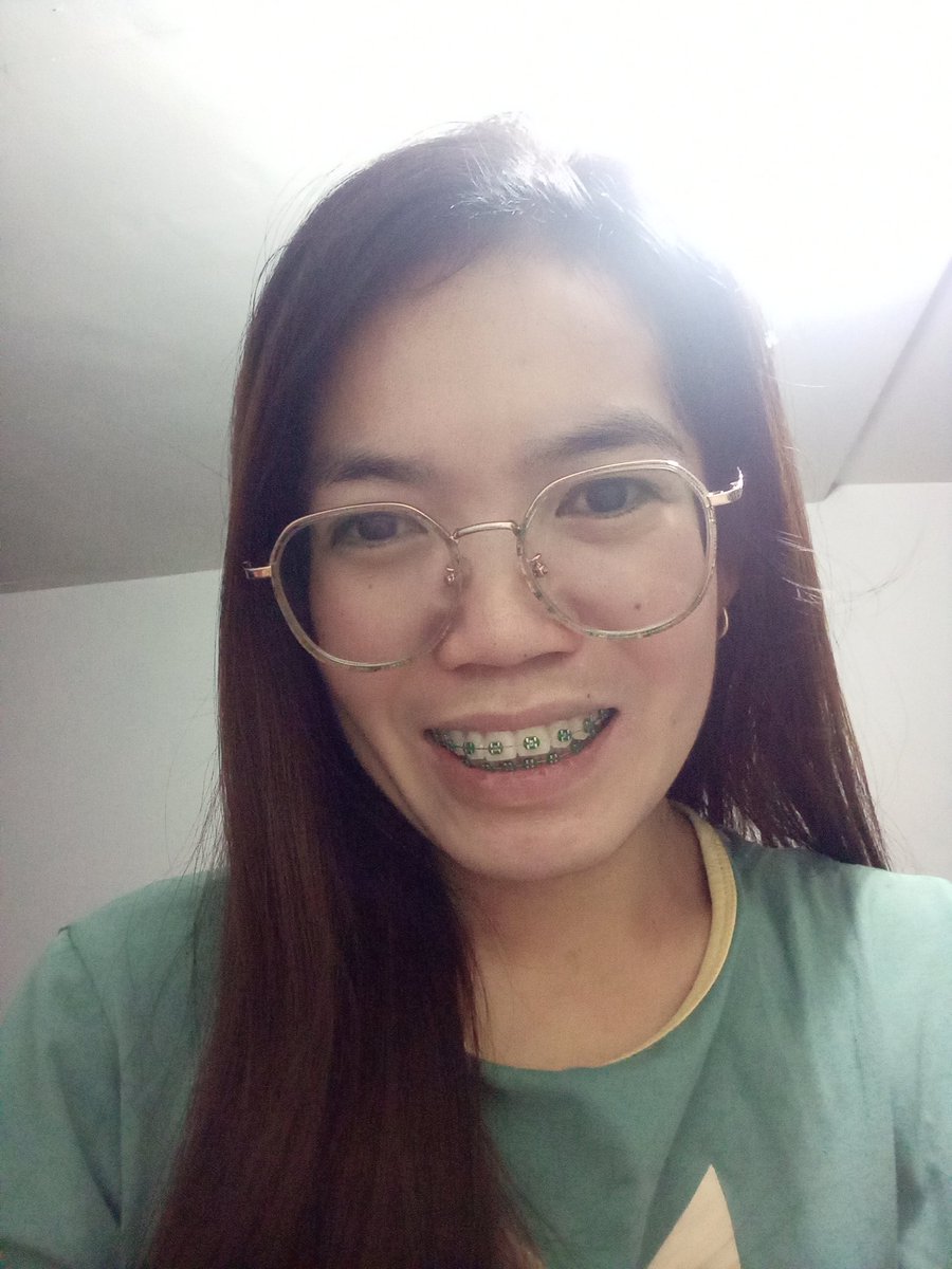 Rolieme22's tweet image. 90th day of braces 😁

#overbite