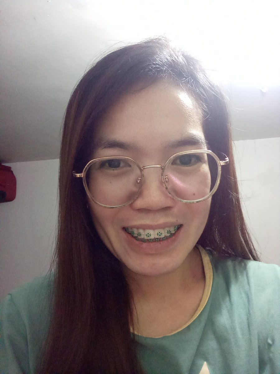 Rolieme22's tweet image. 90th day of braces 😁

#overbite