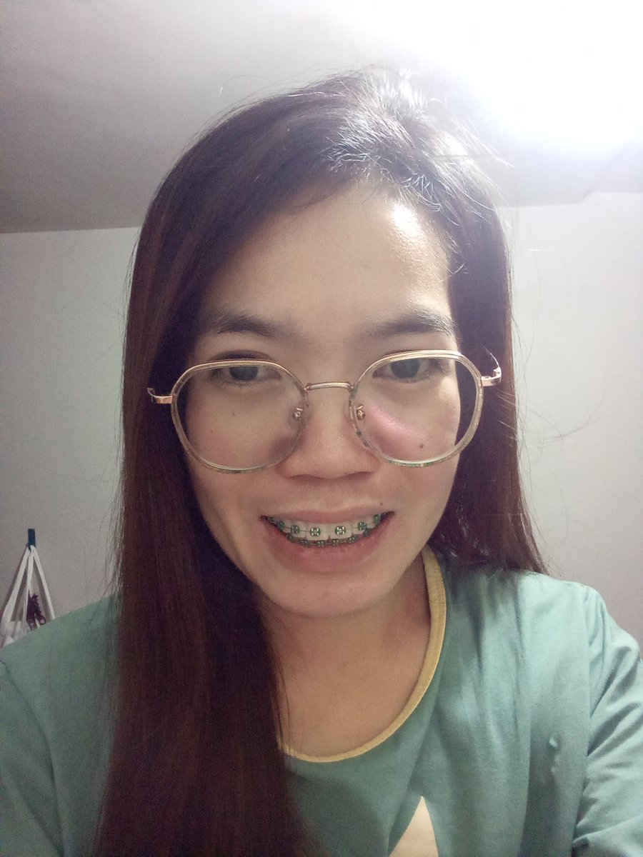 Rolieme22's tweet image. 90th day of braces 😁

#overbite