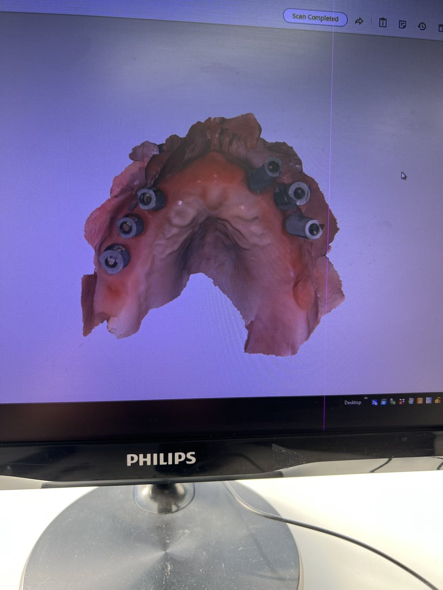 Just when you think it’s a quite Friday afternoon!! These two scans drop.