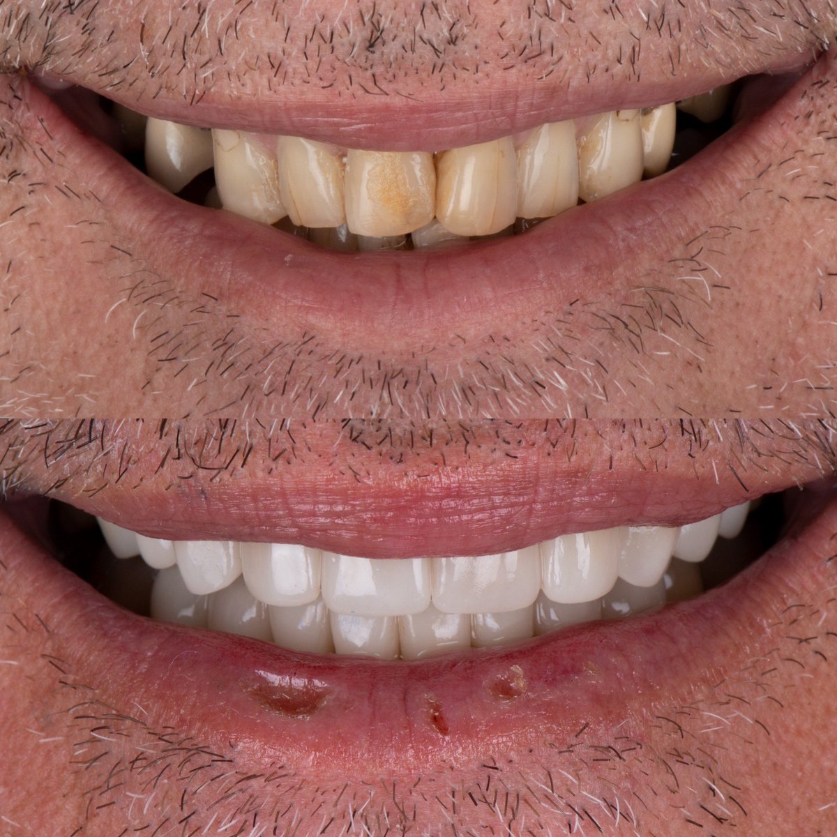 SMILE MAKEOVER!
#jjsdentistry #capetowndentist #CapeTown