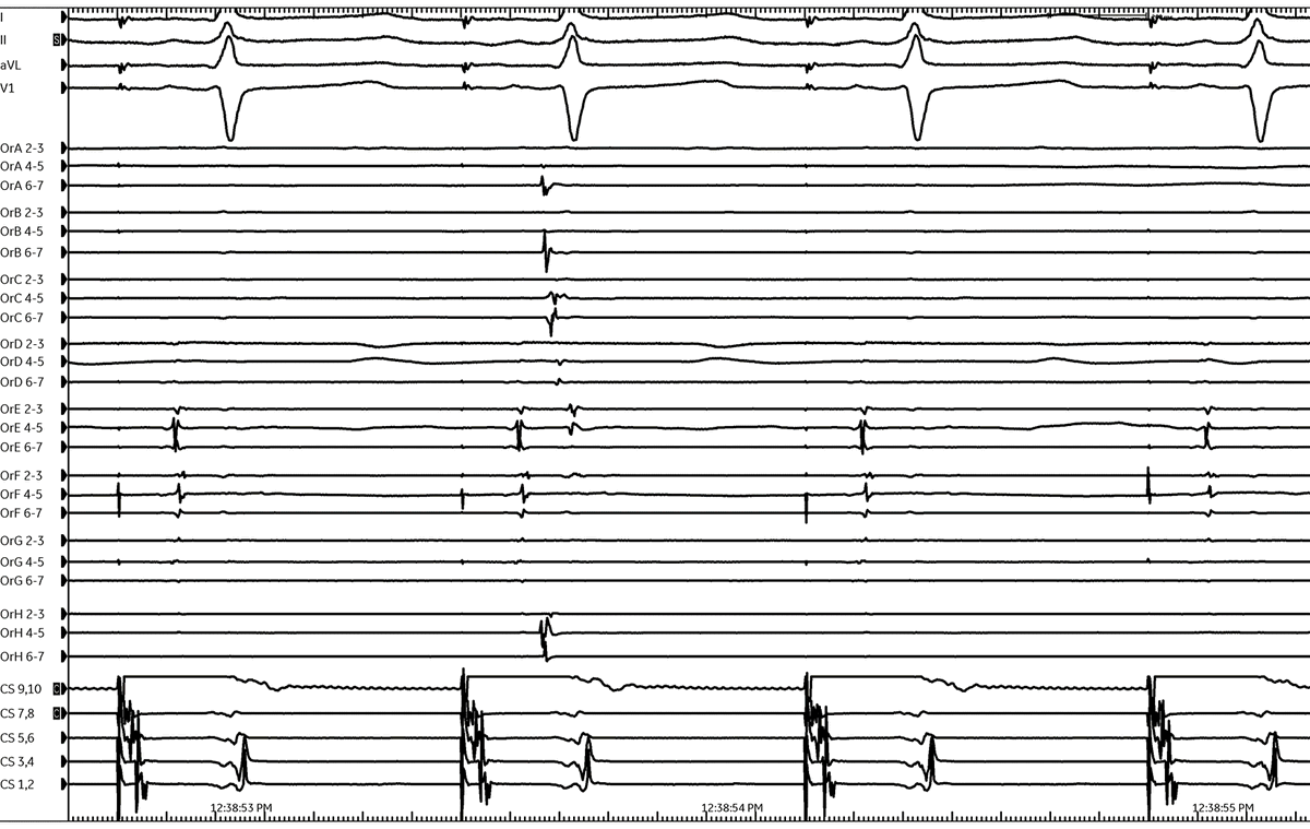 Andrew Beaser tweet media