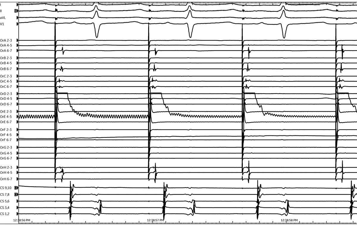 Andrew Beaser tweet media