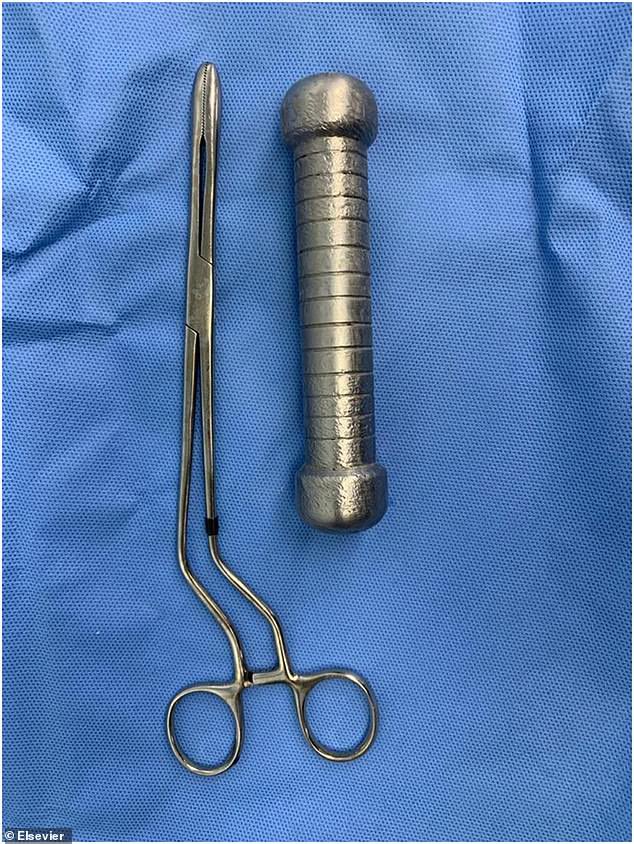 Kadeesayong's tweet image. ชายอายุ 54 ในบราซิลเข้ารักษาตัวในโรงพยาบาลหลังมีอาการปวดท้องถ่ายไม่ออกเพราะมีดัมเบลหนัก 2 กก.ยาว 20 ซม.อยู่ในทวาร จริงๆ มันติดอยู่ในนั้นมาสองวันแล้วเจ้าตัวพยายามเอาออกเองแต่ไม่สำเร็จ หมอต้องใช้มือล้วงเข้าไปเกือบสุดแขนเพื่อดึงมันออกมา