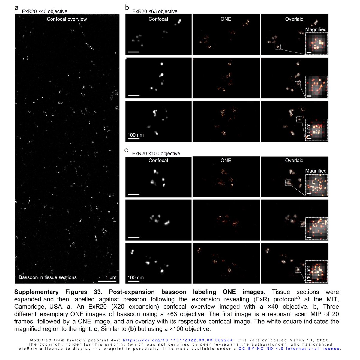 AliHShaib's tweet photo. 🧐😲🙄 Bassoon* what are you doing there?
Very tempting for speculation… Perhaps a spinoff story…
*ONE bassoon in brain tissue sections data is generated by our close friends at MIT @eboyden3 lab
Combining #ONE_Microscopy with #ExR
https://t.co/JYOZkNOIgc
#FluorescenceFriday https://t.co/Rd2ZROi0tU
