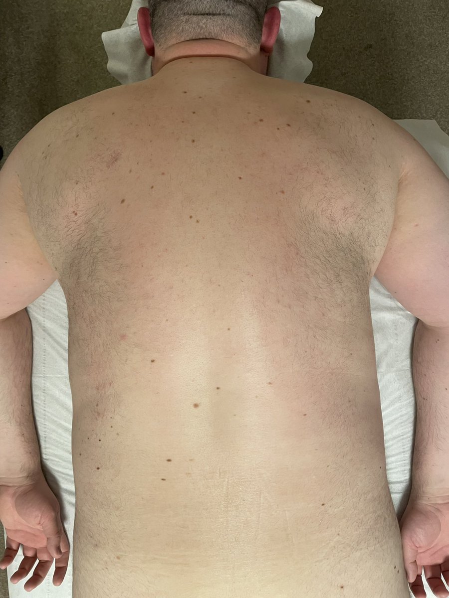 VernallDaniel's tweet photo. Back wax . Smooth and hair free you can book In for. Waxing , massage or skincare by messaging 07769773445 . Taking booking for next week https://t.co/2uWWyiOh8G https://t.co/Wl4QfXDbCM