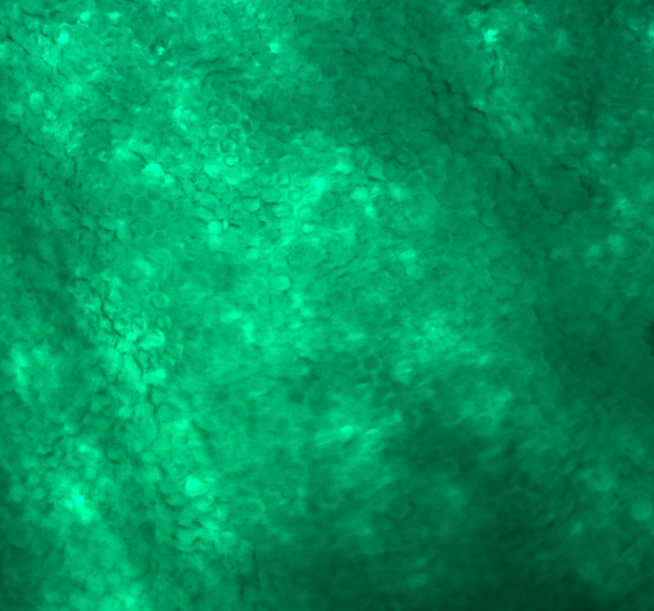 Chenxin Li, PhD (@chenxinli2.bsky.social) tweet media