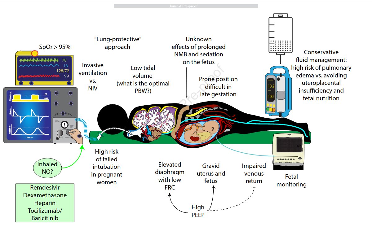 CritCareReviews's tweet photo. Pregnancy and Severe ARDS with COVID-19: Epidemiology, Diagnosis, Outcomes and Treatment
CCR Journal Watch
https://t.co/Sp06oA6IDG https://t.co/WBmMST7F4A