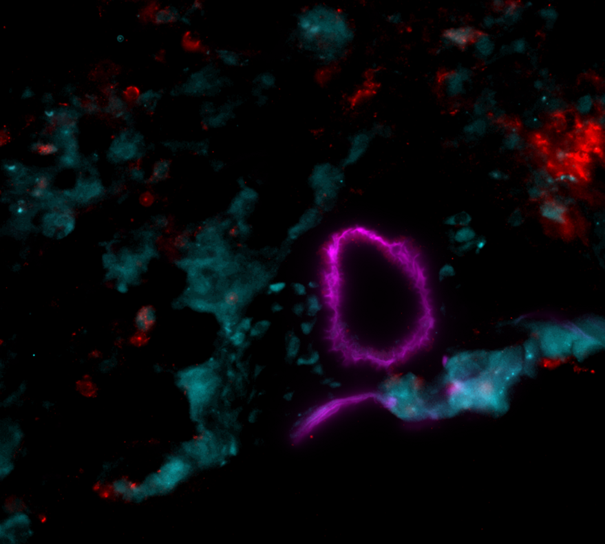 IgM (red) IgA (Cyan) and aSMA (Magenta) in a bleo mouse lung. Question I'm dealing with currently - how could I convince you that the diffuse/amorphous staining is in fact real signal? Assuming isotype controls and FMOs used to set threshold correctly. #FluorescenceFriday
