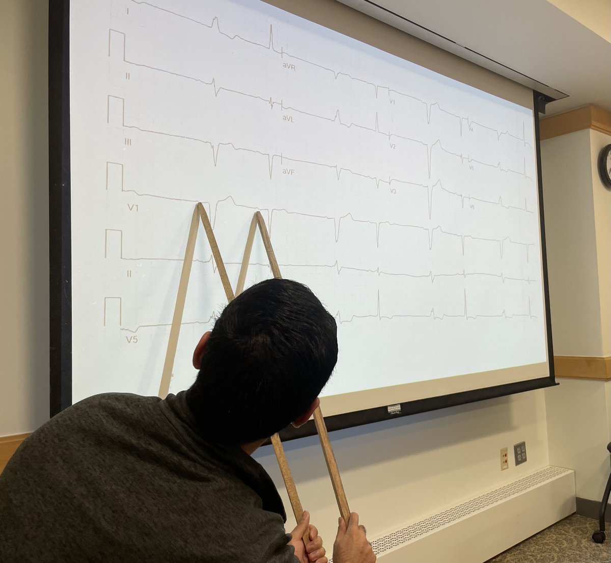Just a totally normal way to spend our Friday morning 🤓😎 😂

#cardiotwitter #whohascalipers #EKGfun 

<a href="/PNPatelMD/">Parth Patel</a> <a href="/jonathan_salik/">Jonathan Salik, MD, MHPEd</a> <a href="/PPodrid/">Philip J Podrid MD</a> <a href="/MGHHeartHealth/">Mass General Heart</a>