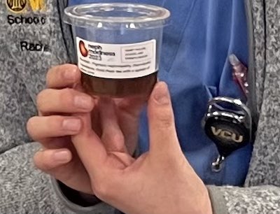 NoWars (@kidneywars) on Twitter photo #NephMadness #CardiacDevices discussed today by <a href="/VCUInternalMed/">VCU Internal Medicine Department</a> <a href="/VCUIMClerkship/">VCU Internal Medicine Clerkship</a> <a href="/VCU_Nephrology/">VCU Nephrology</a>! Behold unmatched presentation skills by Ramez Bodair and <a href="/alley_rd/">reid_alley</a>, with mocktails served by yours truly (Urine in ATN, Urine in Hemolysis, Urine in GN)! #NephMadness #CardiacDevices discussed today by <a href="/VCUInternalMed/">VCU Internal Medicine Department</a> <a href="/VCUIMClerkship/">VCU Internal Medicine Clerkship</a> <a href="/VCU_Nephrology/">VCU Nephrology</a>! Behold unmatched presentation skills by Ramez Bodair and <a href="/alley_rd/">reid_alley</a>, with mocktails served by yours truly (Urine in ATN, Urine in Hemolysis, Urine in GN)!