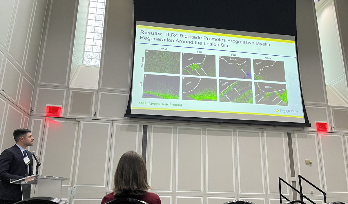 Mahmoud G. El Baassiri (@baassirimg) on Twitter photo Thrilled to have participated and presented at the NCA TBI Research Symposium. Great opportunity to learn about the latest advancements in TBI research. @CNRMstudies <a href="/HopkinsKids/">Johns Hopkins Children's Center</a> <a href="/JHCCTraumaBurn/">Johns Hopkins Pediatric Injury Prevention Program</a> <a href="/nasr_isam/">Isam W. Nasr</a>
#2023_TBISYMP #reThinkTBI Thrilled to have participated and presented at the NCA TBI Research Symposium. Great opportunity to learn about the latest advancements in TBI research. @CNRMstudies <a href="/HopkinsKids/">Johns Hopkins Children's Center</a> <a href="/JHCCTraumaBurn/">Johns Hopkins Pediatric Injury Prevention Program</a> <a href="/nasr_isam/">Isam W. Nasr</a>
#2023_TBISYMP #reThinkTBI
