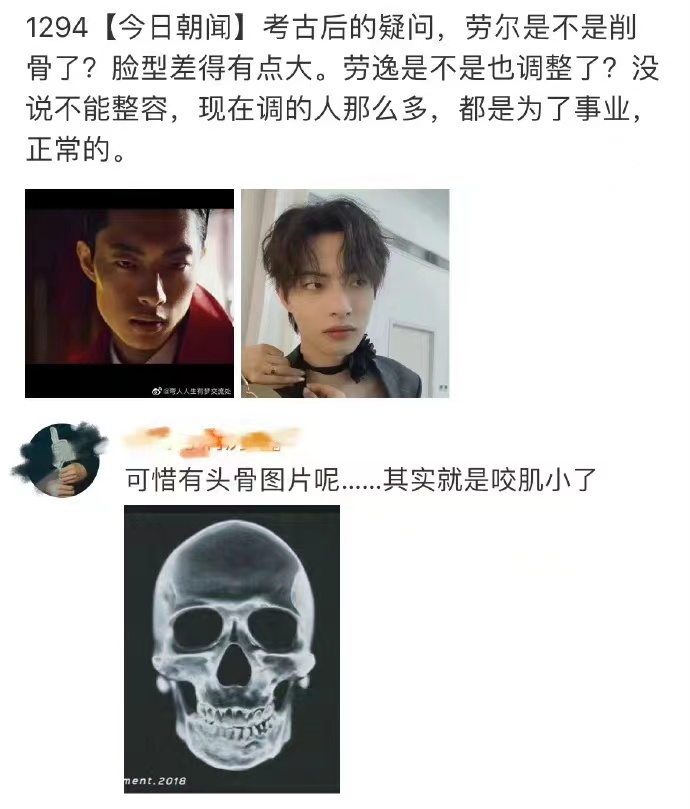 melonconsumer's tweet photo. A #MuZiyang fan went viral for using a picture of his skull to prove that he hadn't gotten plastic surgery

Then MZY himself started trending because he was confused af about how fans have a picture of his skull https://t.co/WXCNlLEl8I