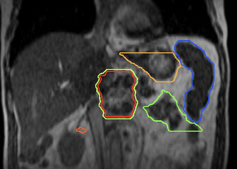 Michael Chuong tweet media