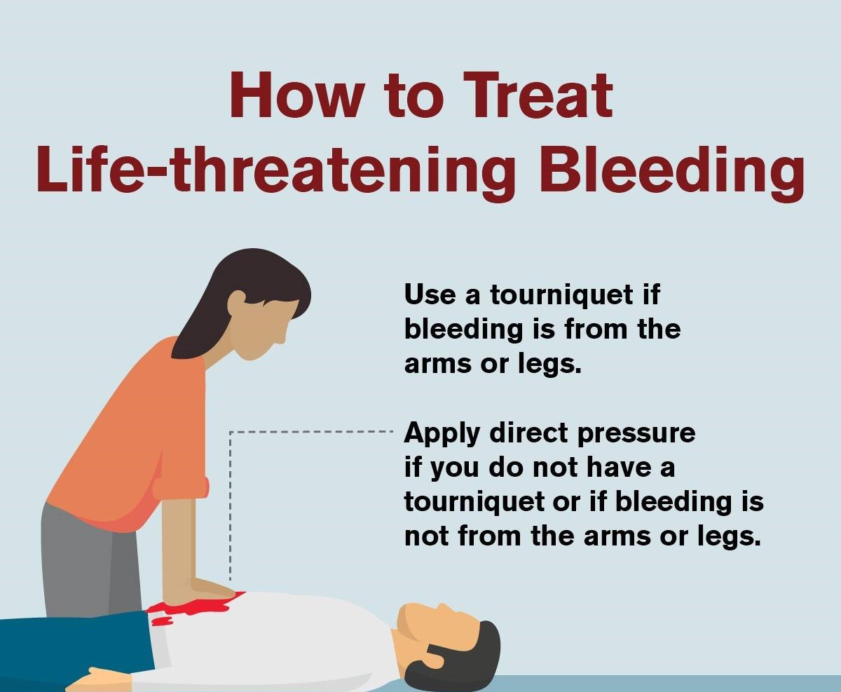 On Bleeding Disorder Awareness Month (BDAM), some quick emergency bleeding control techniques that can help save a life include:
Applying proper pressure
Correctly packing a wound
Placing a tourniquet
#bleedingdisorder #awarenessmonth #BSAM #bleedingcontrol #emergencymedicine