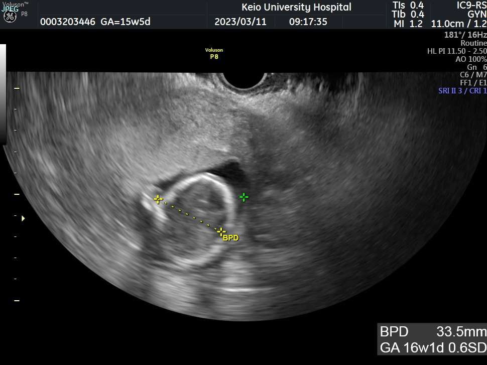 CashMeow on Twitter "Pregnancy 5th month for Ayako!"