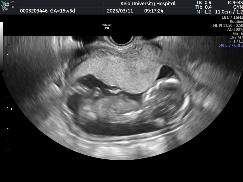 CashMeow on Twitter "Pregnancy 5th month for Ayako!"