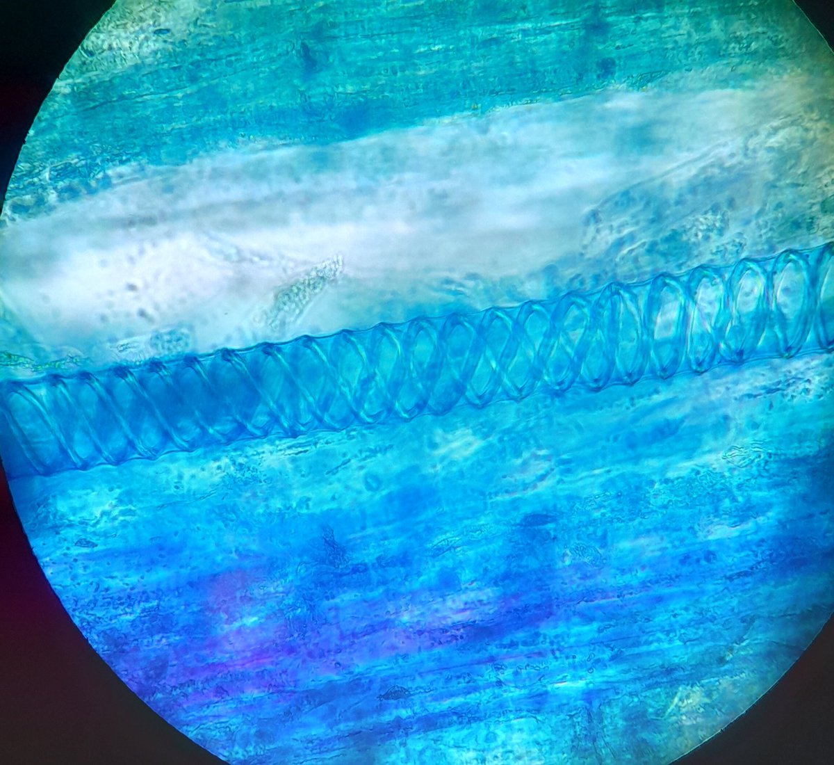 Great stain of a rhubarb xylem by the 6th form last week. #biologyteacher